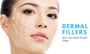 What are dermal fillers and why you have to get them?
