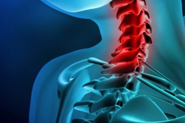 What are the common neck injuries? How can a solicitor help you?