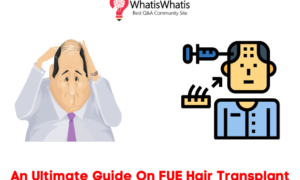An Ultimate Guide On FUE Hair Transplant