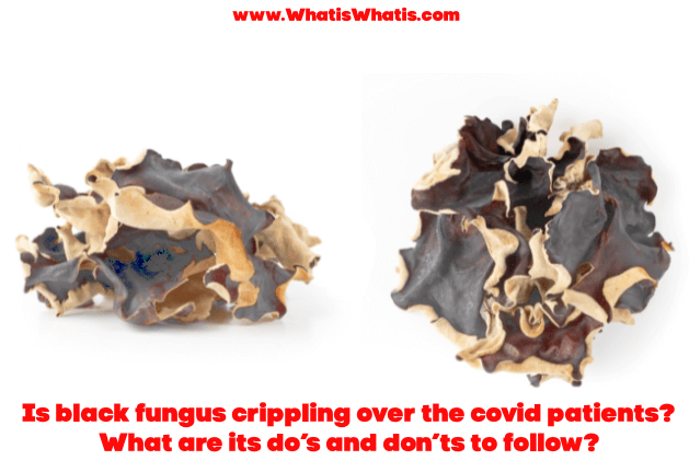 Is black fungus crippling over the covid patients? What are its do’s and don’ts to follow?