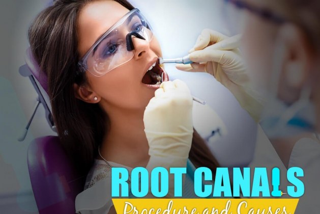 Root Canals: Procedure and Causes